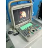 Chison Q5 Ultrasound