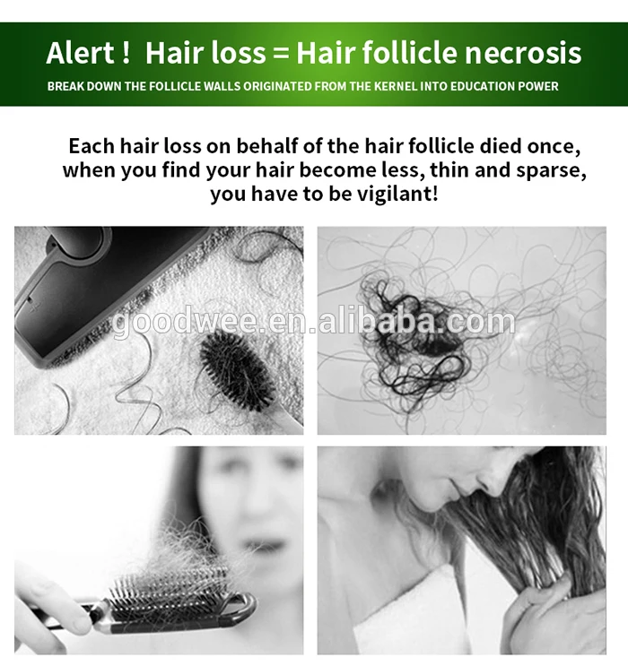 Herbaceous Plants Ingredient Loss Treatment Hair Grow Condition Buy
