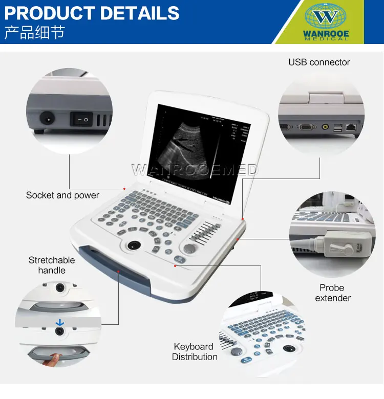 Medical Laptop Digital Portable Echography Therapeutic Ultrasound Machine in Germany.jpg