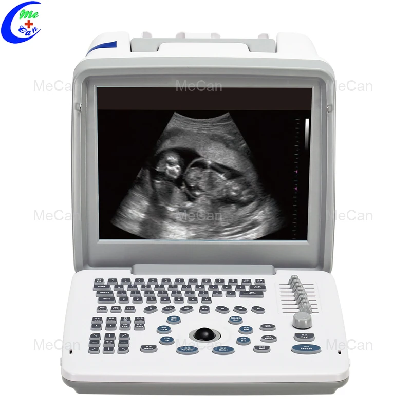Portable Full Digital Ultrasound Diagnostic System