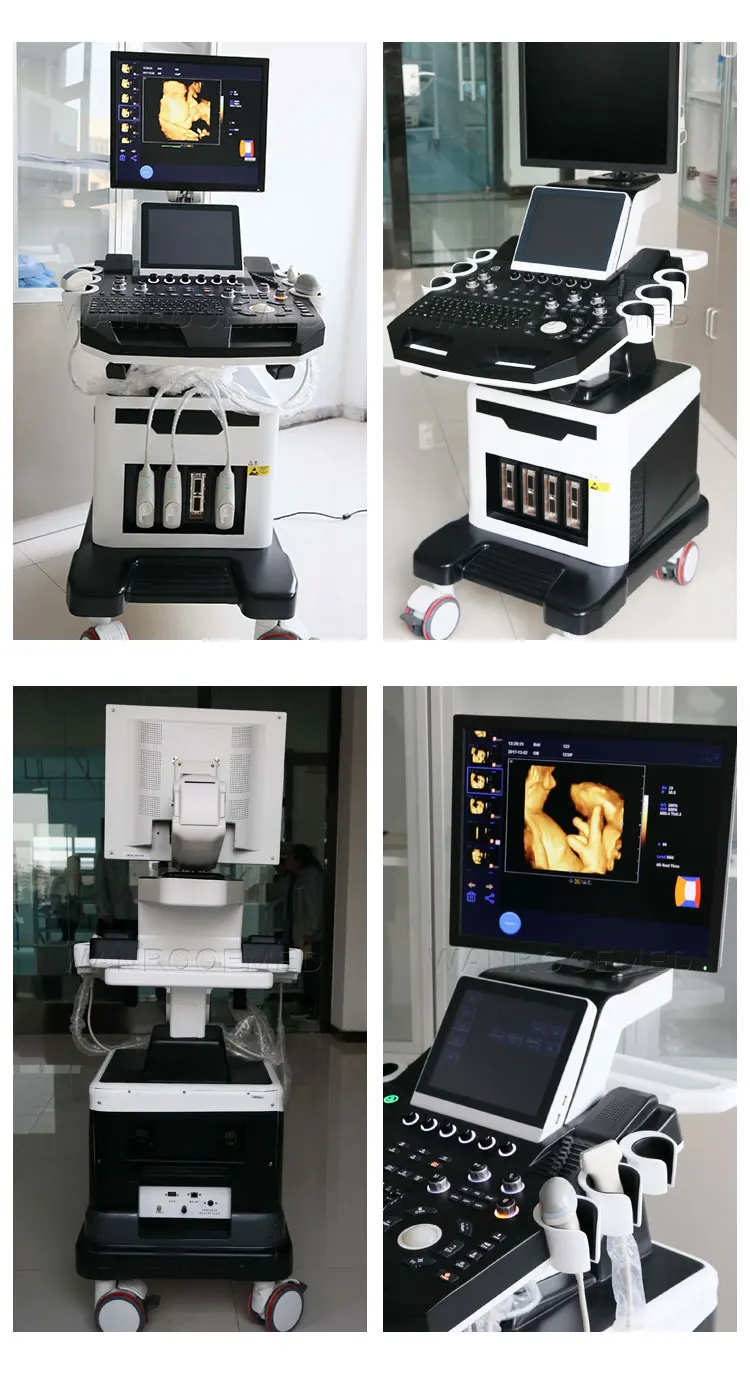 CE ISO FAD Approved 4D Color Doppler 360 Ultrasound Probe  Head Machine.jpg