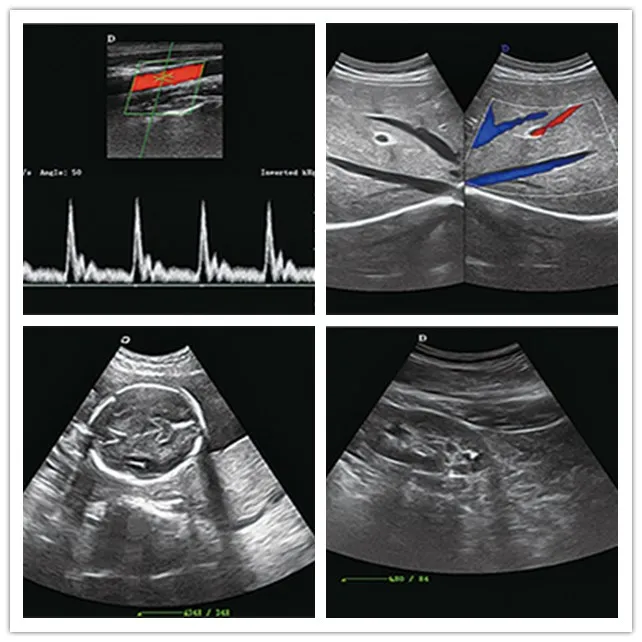 4d Color Doppler Ultrasound Imaging System/ultrasound Diagnostic ...