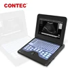 CONTEC CMS600P2-VET portable vet ultrasound scanner vet