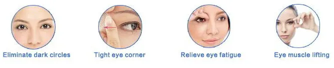 R3 eye