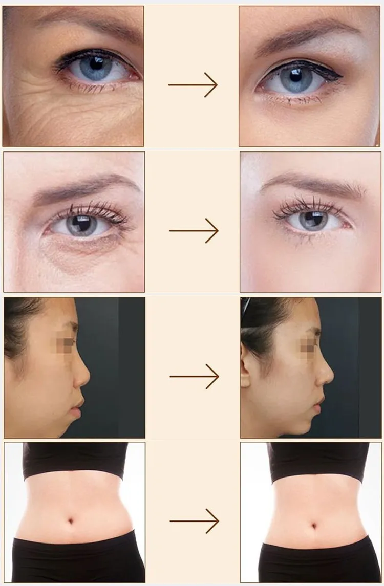 before and after.jpg