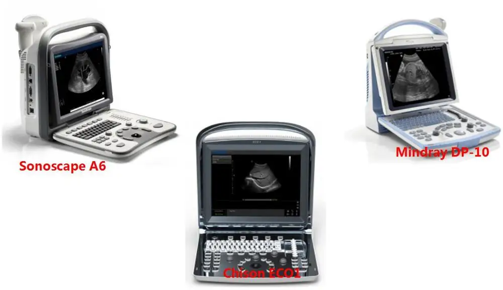 Black white Ultrasound Machine Cheap Ultrasound Machine B ultrasound Machine