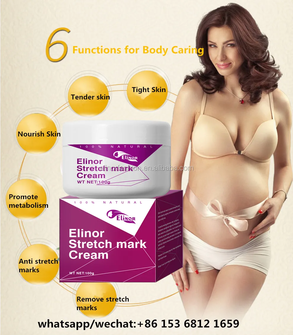 Stretch marks-01.jpg