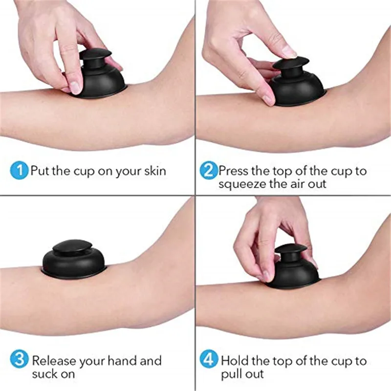 Easy cupping cups.jpg