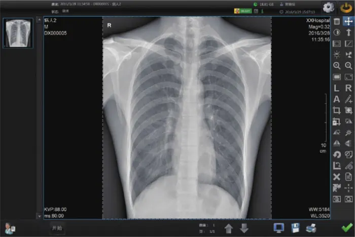 YSFPD4343A Wired or wireless veterinary human software cassette-sized x-ray digital detector DR flat panel