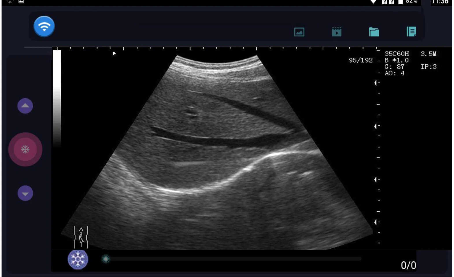 Wireless Ultrasound Probe