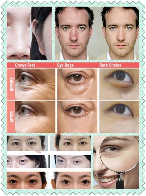 under eye best products