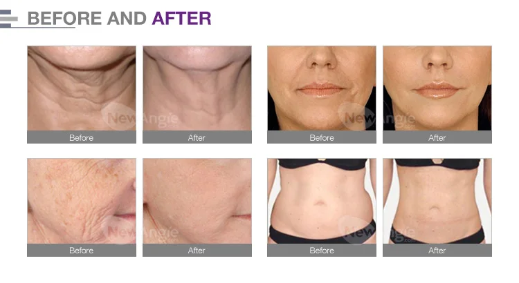 Treatment comparison.jpg