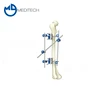 Orthopedic Surgical Instruments Hoffmann Tibia & Percone External Fixation System