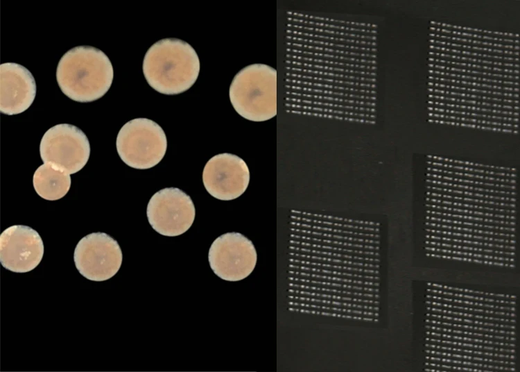 laser tattoo removal