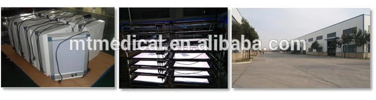 D2 Medical Equipment New X-ray Film Viewer