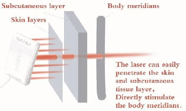 Hemotherapy Laser High Blood Sugar Viscosity Cholesterol Lower Level Therapy Laser Watch