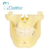 most popular orthodontic implant model for showing the exact position for ortho implant