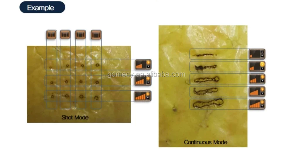GOMECY Medical Plasma shower handle surginal or needle handle machine skin rejuvenation for antibacterial antivirus.jpg