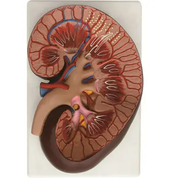 Unduh 9500 Koleksi Gambar Ginjal Glomerulus Paling Bagus HD