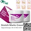 Natural raw materials made OEM/ODM/OBM Natural Organic Stretch Mark Removal Cream for Stretch marks