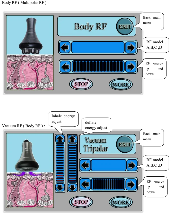 fat brain vacuum