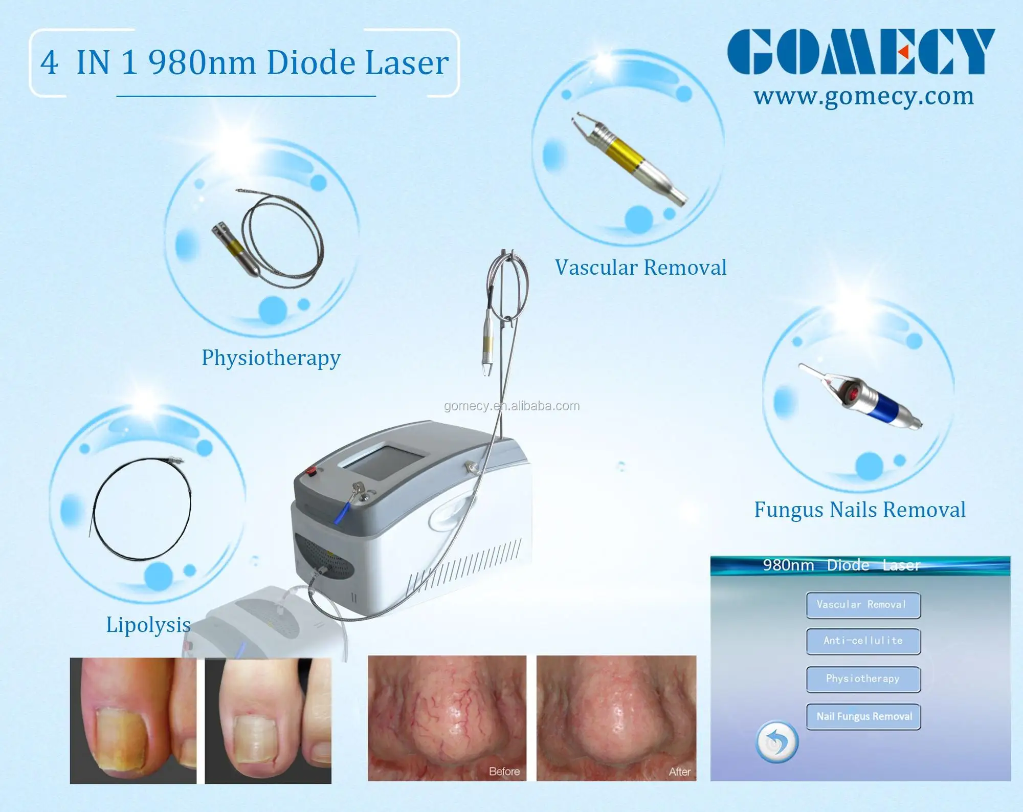 class 4 laser treatment