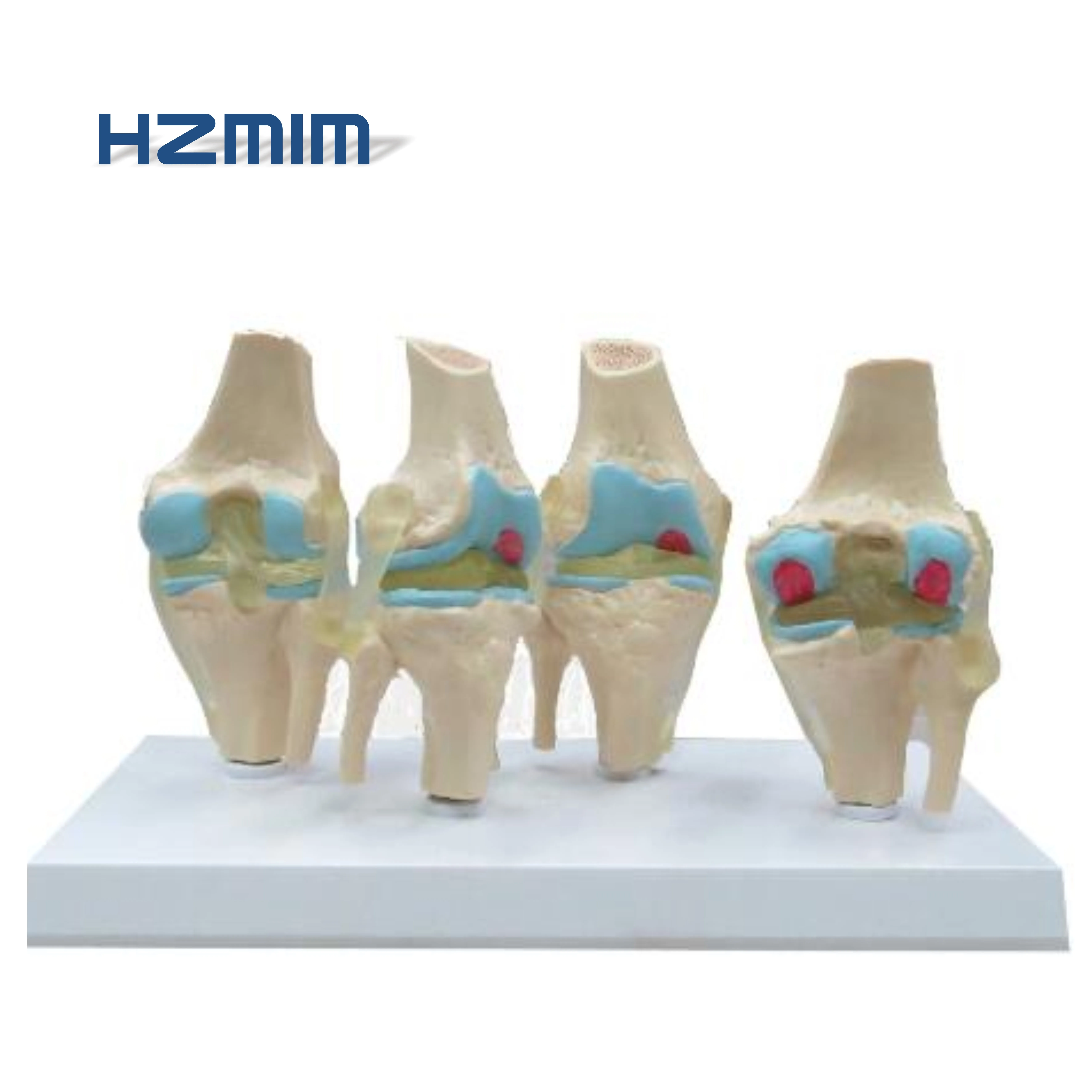 knee joint model.jpg