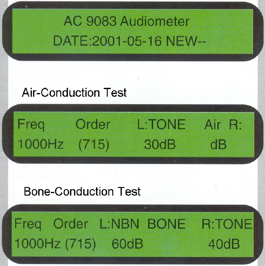Audiometer