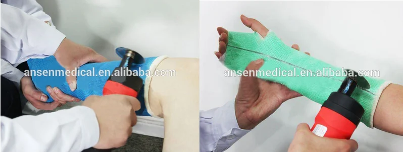 how to remove a cast