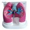 Plastic Medical Anatomical Teaching Bronchopulmonary Disease Pathological Lung Model for student