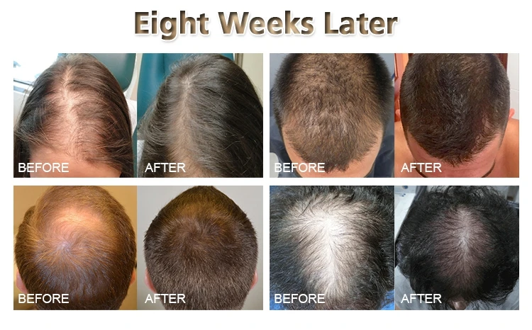 anti hair loss (6).jpg