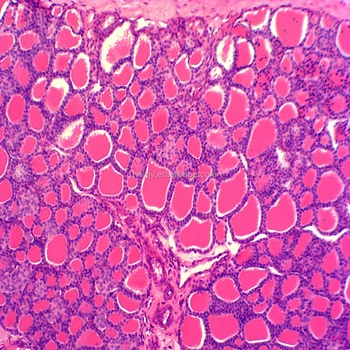 Simple Squamous Epithelium Histology Labeled