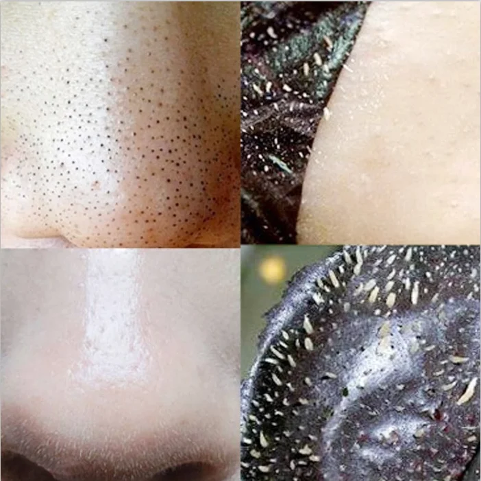 Как снять маску пленку с лица Wholesale Deep Cleansing Blackhead Removal Charcoal Peel Off Mask - Buy Powder P