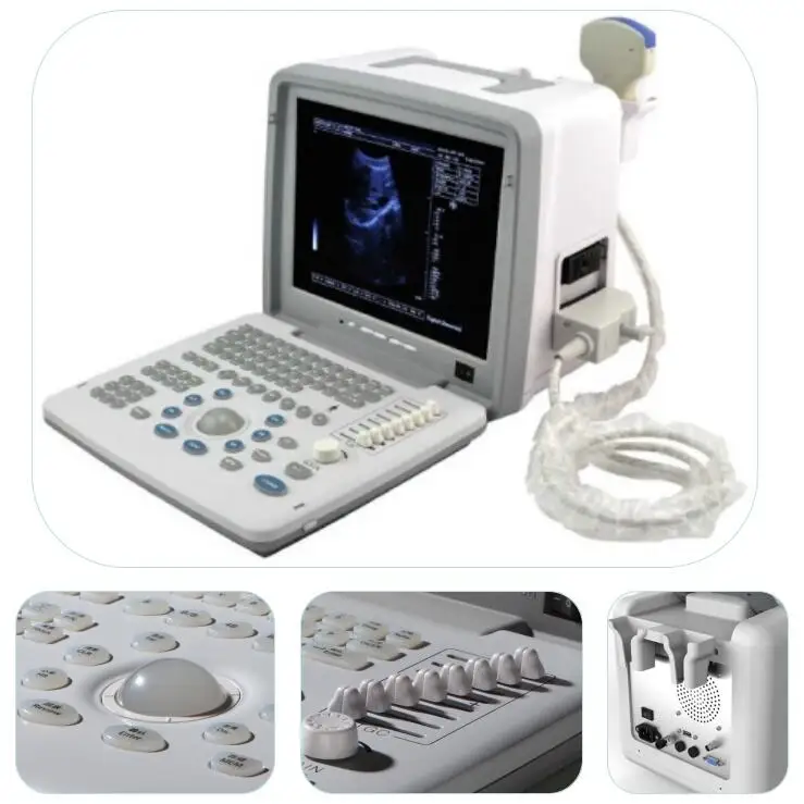 Portable Ultrasound Machine/handheld Ultrasound Scanner/echo Ultrasound