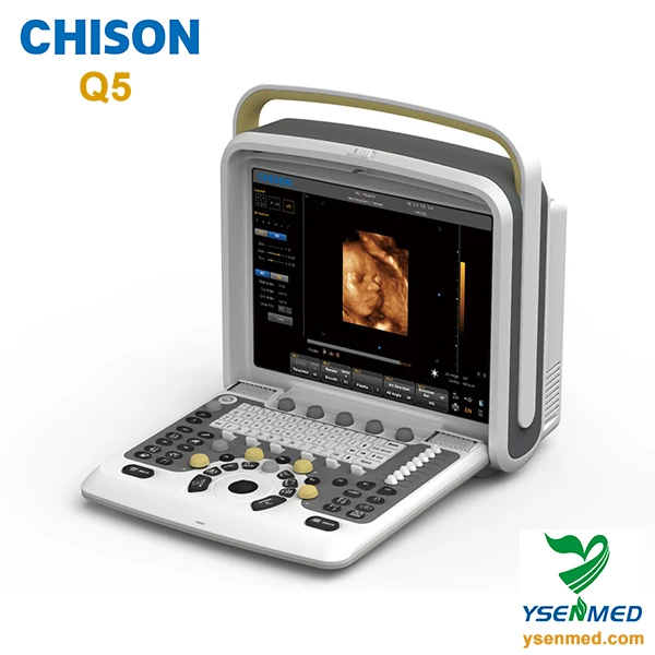 Ultrasonidos Ecografo 3d 4d Best Price Chison Q9 Digital Portable Ultrasound Machine With Fda Ce Certificate