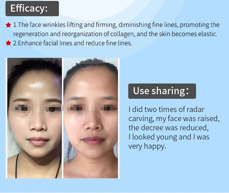 radar line carver (9).jpg