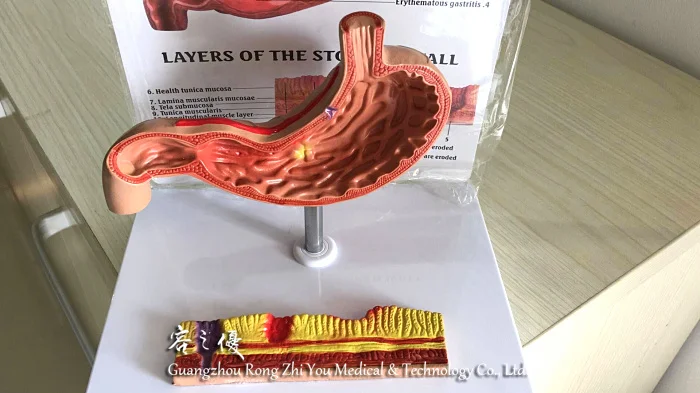 用粘土做胃的模型图片