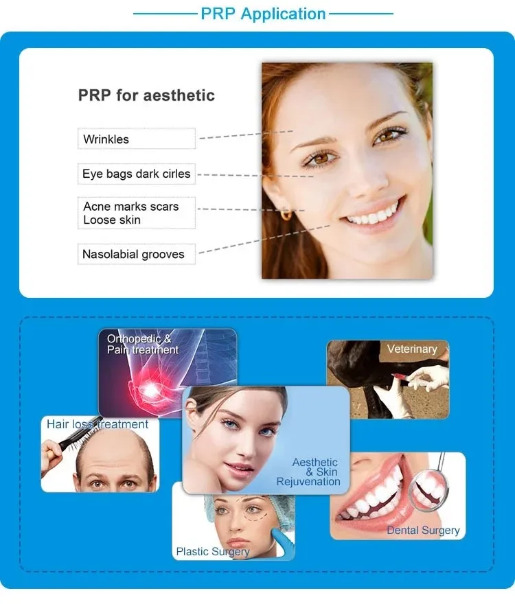 Platelet Rich Plasma Prp Tubes And Tube Prp With Acd And Gel Buy Prp Tube Prp Tube With Acd Gel Prp Product On Alibaba Com