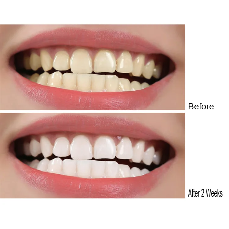 before after