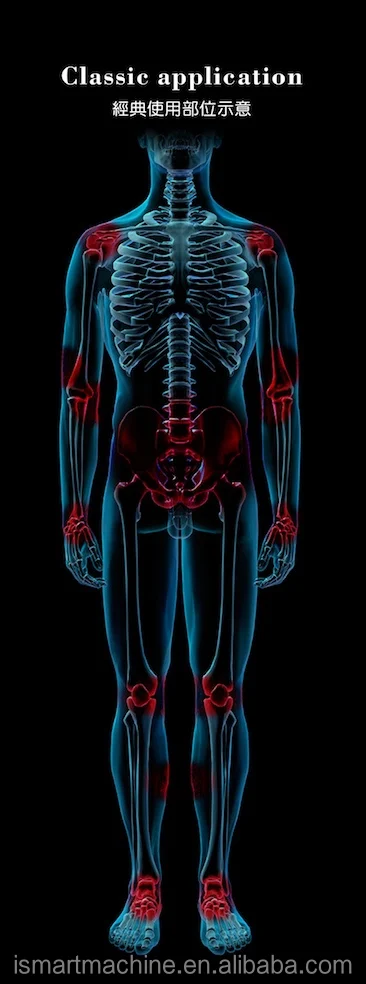 Classic application shock wave.jpg