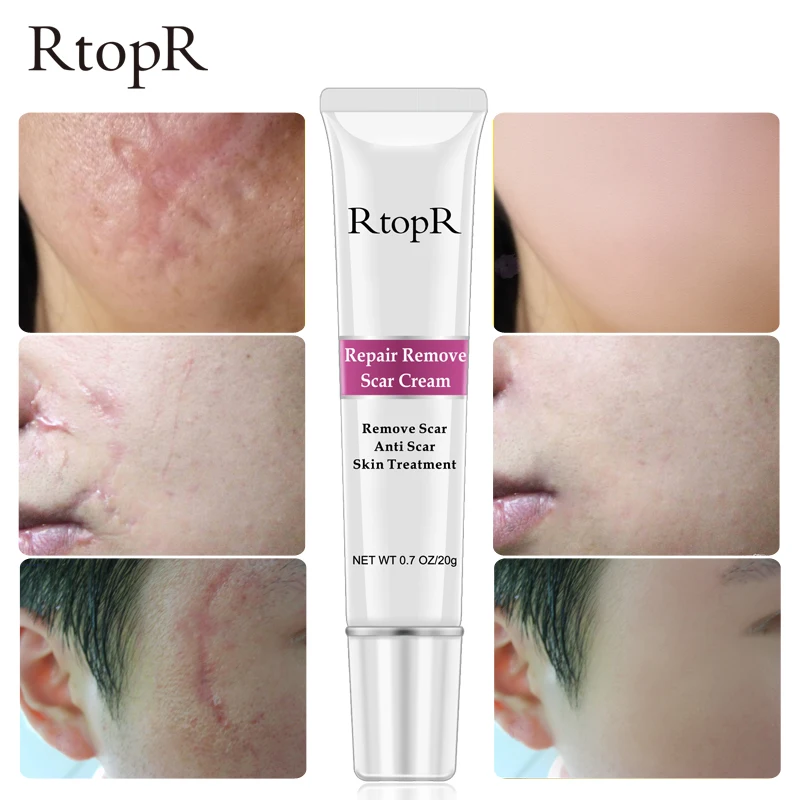 repair remove scar cream