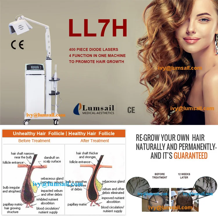 diode laser ivy.jpg