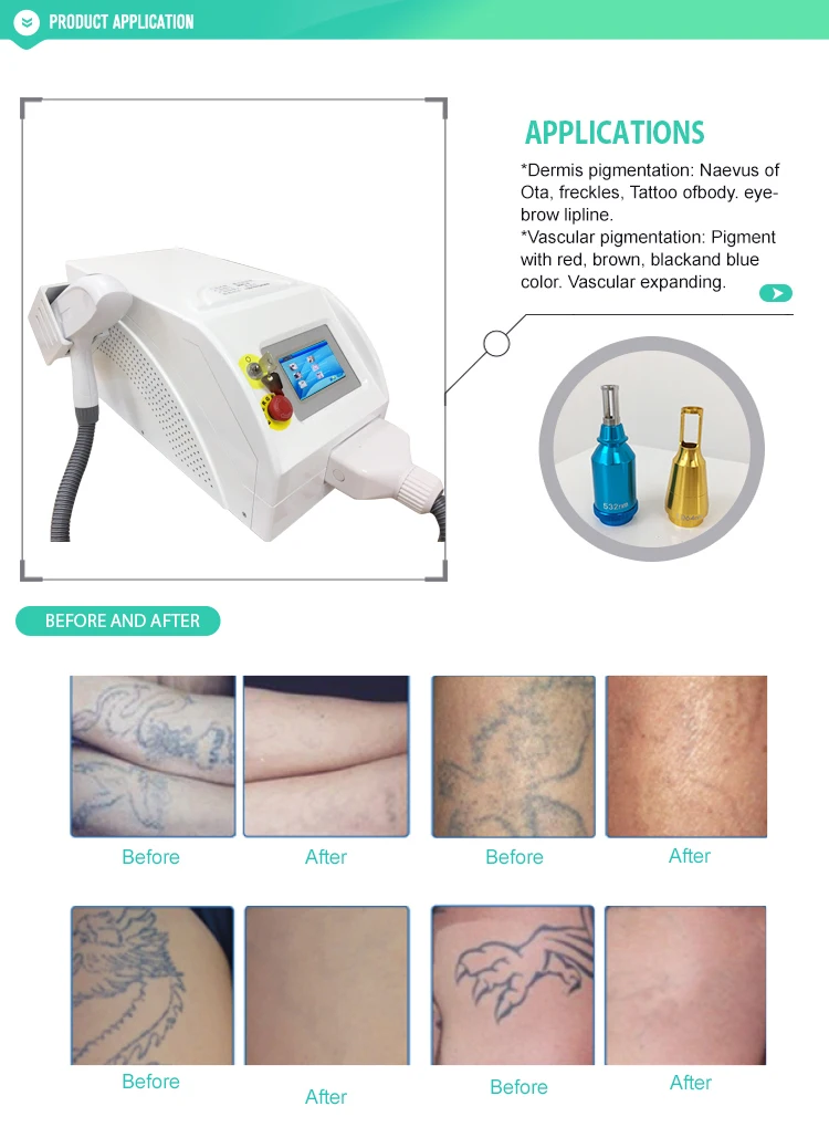 Multifunctional Laser Nd Yag Beauty Skin Whitening Ipl Opt Hair Removal Machine