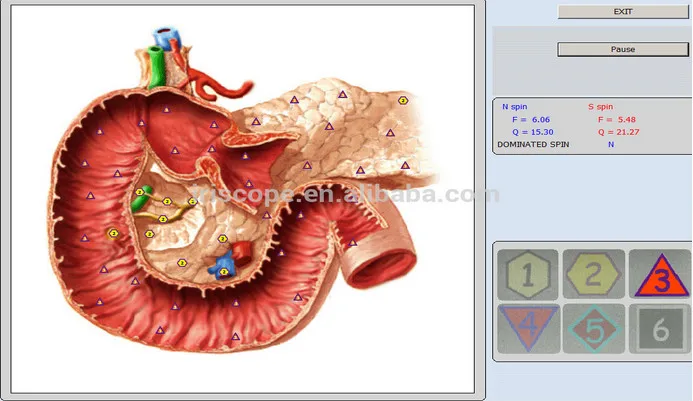 专业 8d nls 全身健康分析仪与生物树脂软件