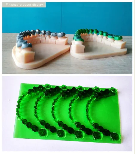 ESUN-resina moldeable para impresora dental, resina sensible a los rayos UV de 405nm para impresora 3D LCD/DLP, 1KG
