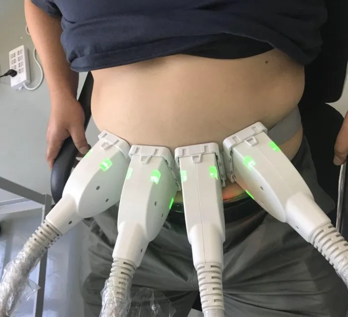 Super Diode Laser 1060nm Sculpsure Slimming System Buy Slimming