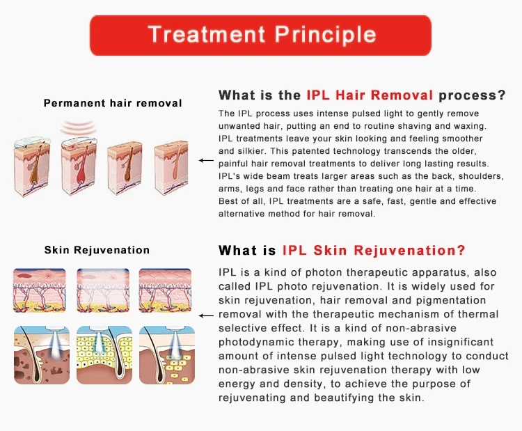professional ipl pigmentation epilator laser hair removal portable