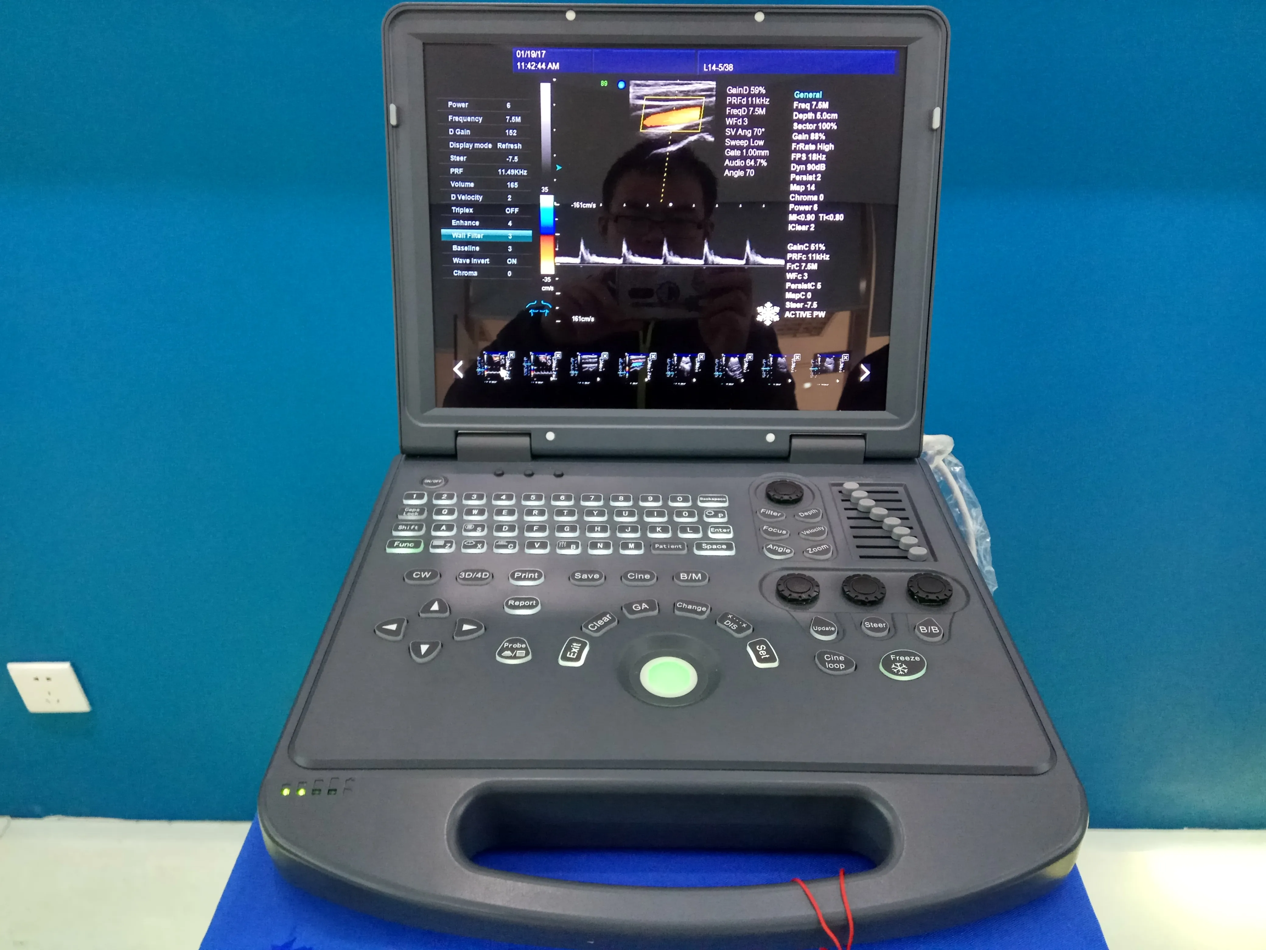 Medical portable 3D/4D cardiac color ultrasound machine for adult