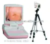 SW3301 Vaginal Speculum/optical digital colposcope