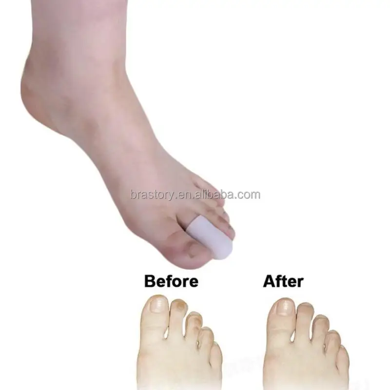 silicone toe cap